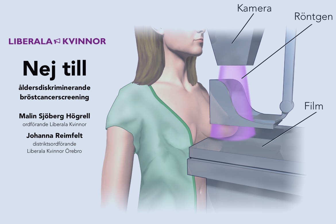 Nej till åldersdiskriminerande bröstcancerscreening